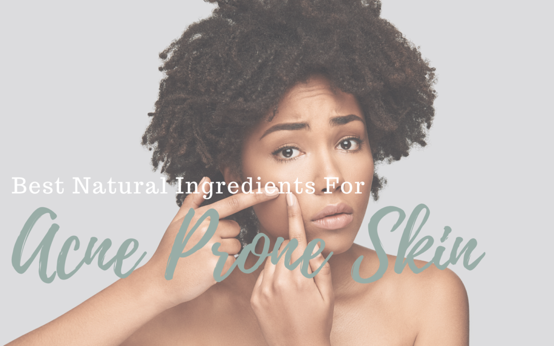 Best Natural Ingredients For Acne Prone Skin
